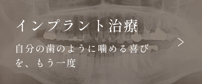 インプラント