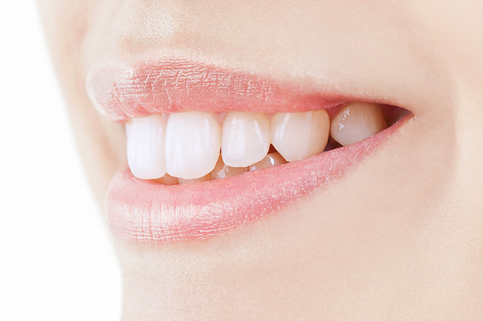 ホームホワイトニングで長期にわたり白く美しい歯を保つ。